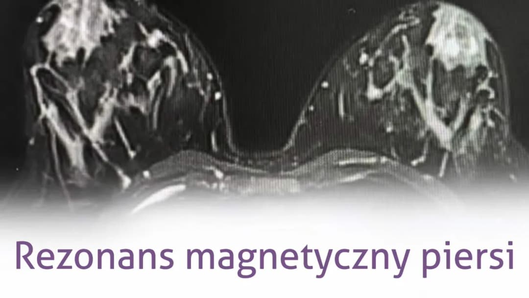 Mammografia czy rezonans - która metoda diagnozy raka piersi jest lepsza?