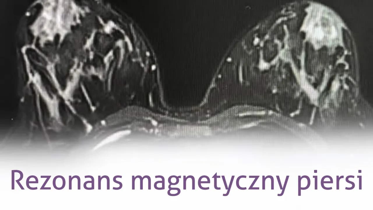 Mammografia czy rezonans - która metoda diagnozy raka piersi jest lepsza?